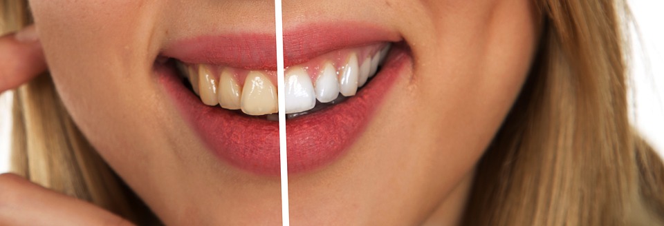 5 bebidas que manchan tus dientes